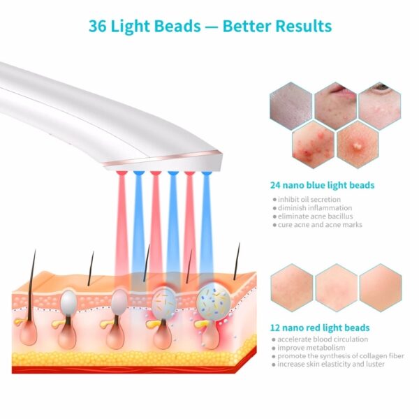 Rechargeable Acne Clearing Light Therapy Tool - Image 8