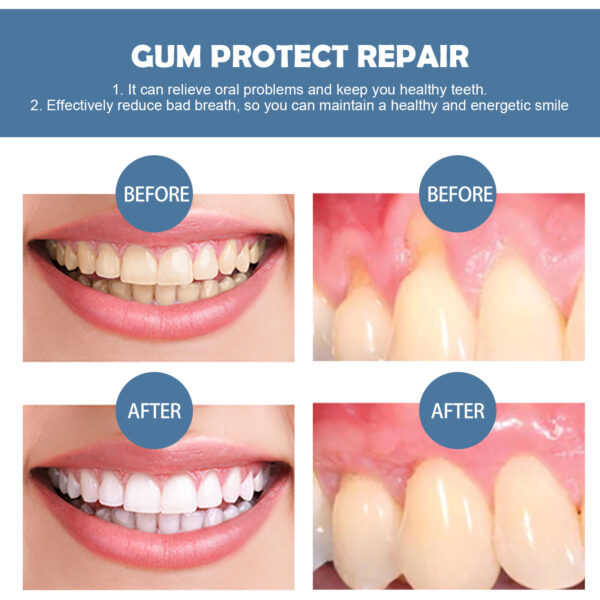 EELHOE Gum Repair Series Cleaning - Image 8