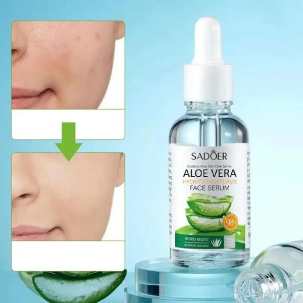 SADOER Aloe Vera Gel – 2-Pack for All Skin Types - Image 2