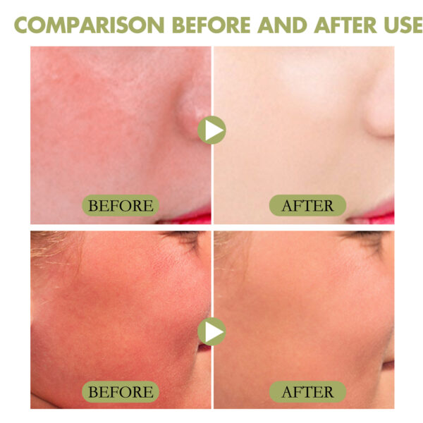 Jaysui Summer Skincare Stick with UV Protection - Image 3